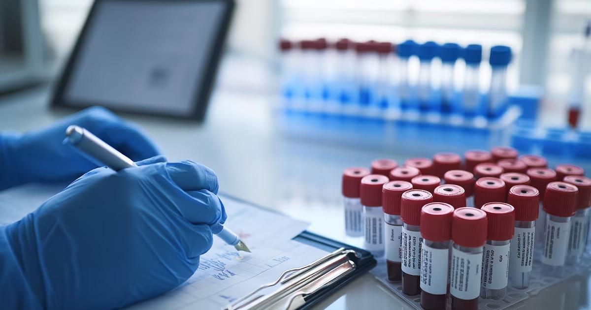 ANMAT aprueba nueva alternativa para paciente con mieloma muacuteltiple