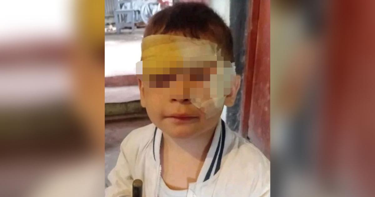 Un perro ingresoacute a una casa atacoacute a un nintildeo y lo dejoacute gravemente herido