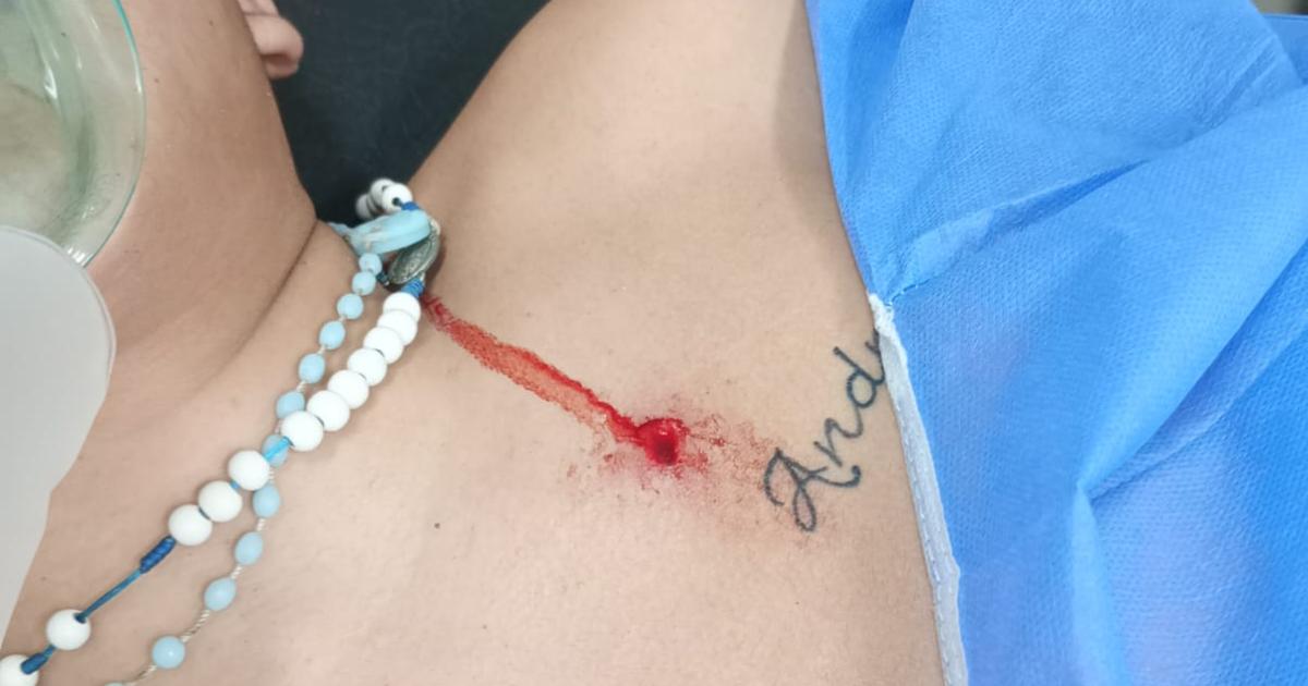 Adolescente de 16 antildeos fue baleado en pelea entre grupos