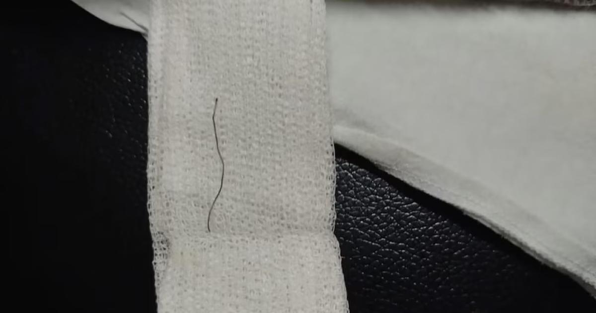 El hospital Materno Infantil de Mar del Plata halló mediante estudios por im�genes un alambre fino incrustado en la garganta del paciente (Foto-0223)