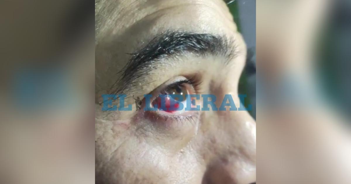 Antildeatuya- fue a reclamar por el robo de gasoil de sus camiones y terminoacute brutalmente golpeado