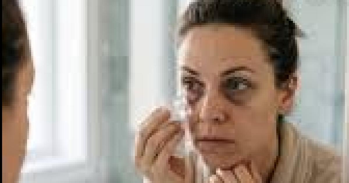Ojeras y bolsas- queacute las causa coacutemo reducirlas y cuaacutendo son una sentildeal de alarma seguacuten expertos