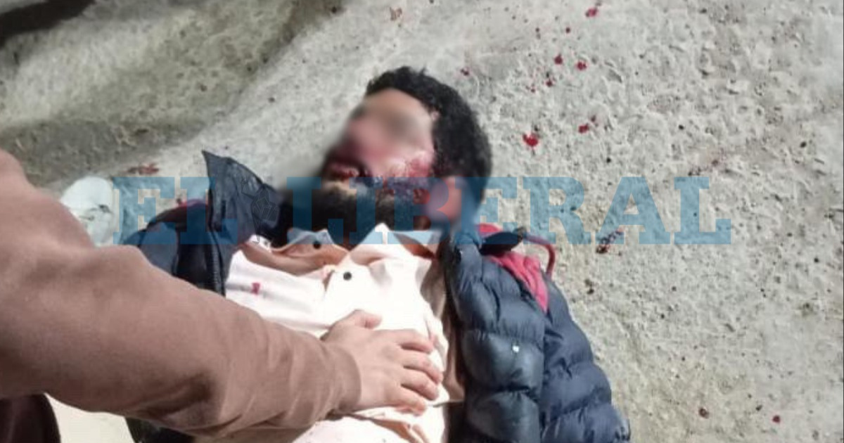 Brutal golpiza- un joven fue agredido a la salida de un boliche en la ciudad de Bandera