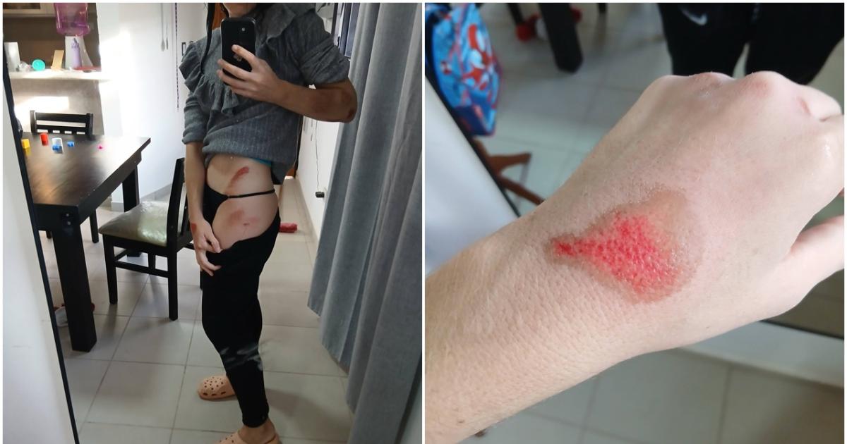 La mujer expuso a su ex y mostró las fotos de sus lesiones (Fotos- Facebook)