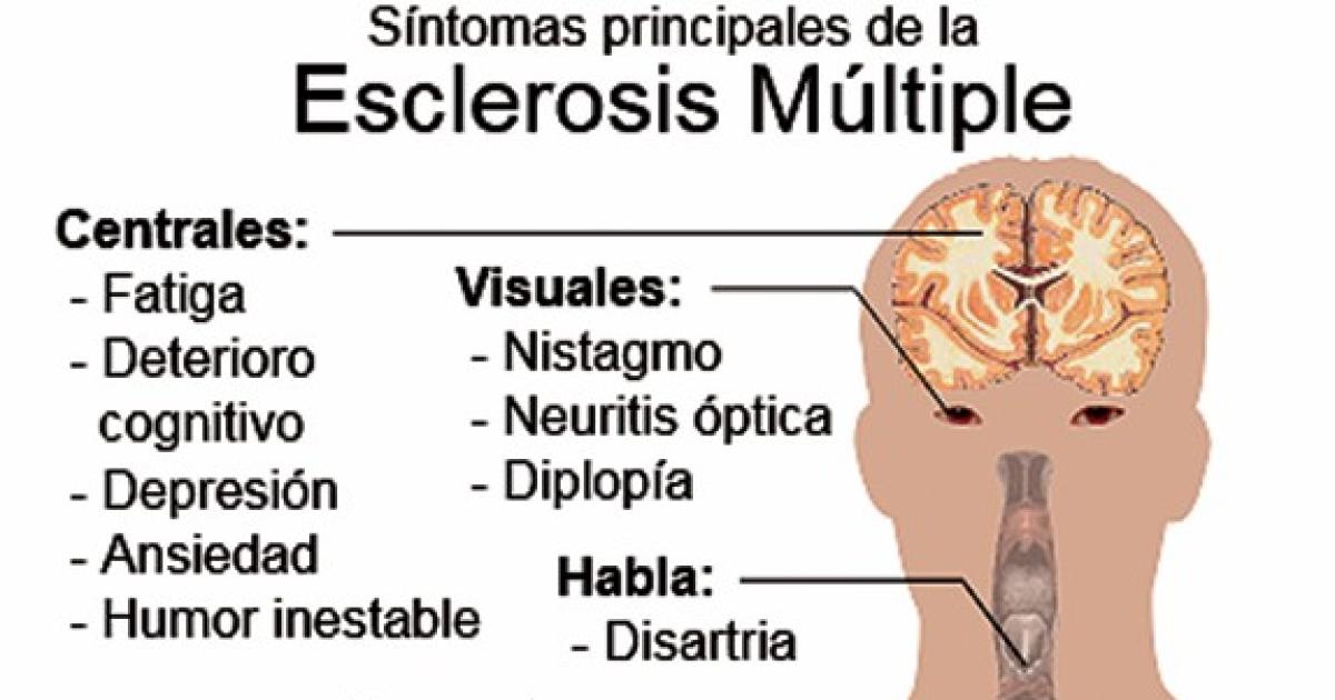 Dr Jorge Correale- En el mundo existen aproximadamente 1000000 de personas  con esclerosis muacuteltiples