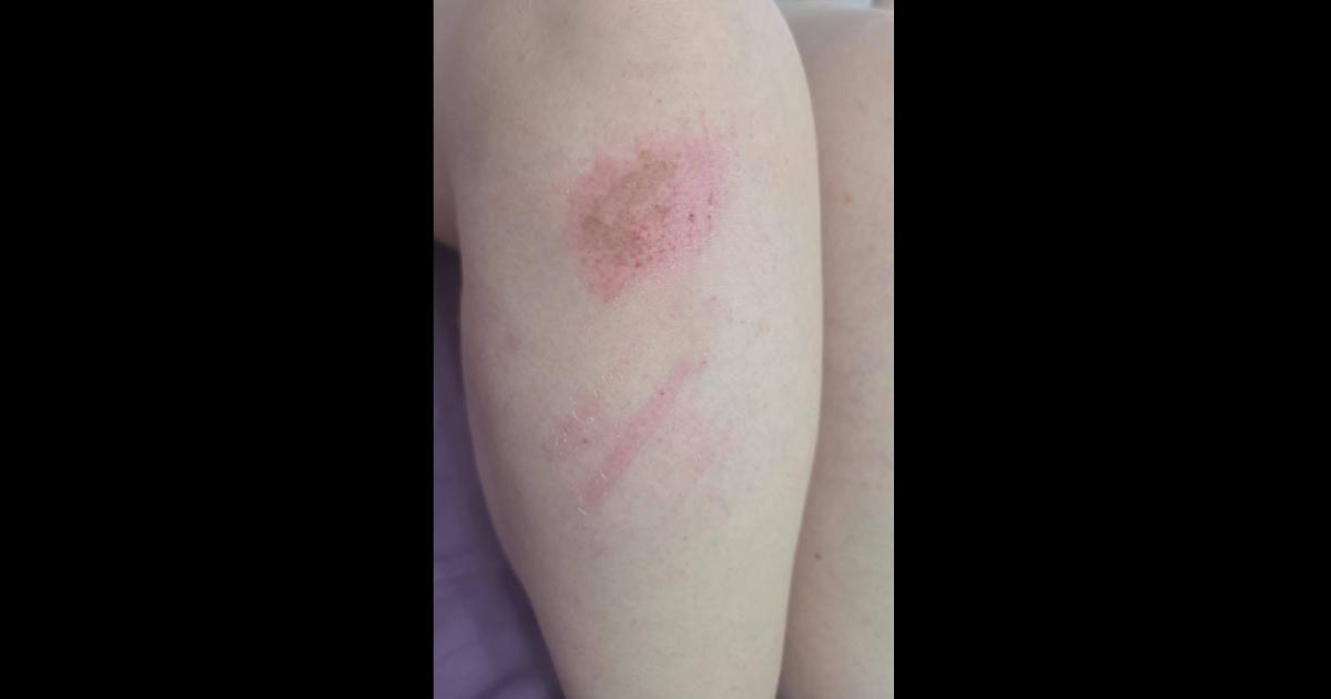 Docente reclamoacute por ruidos de una fiesta y recibioacute una golpiza