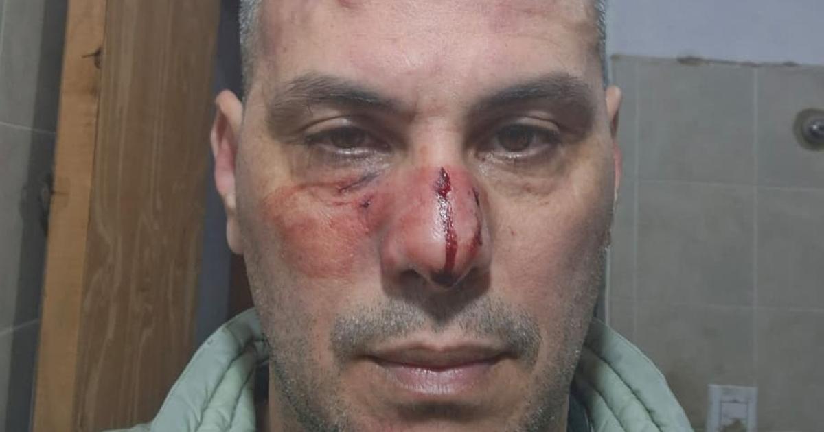 Vecino de Tintina reprocha a sujetos por orinar al aire libre frente a su sobrina menor y recibe una golpiza