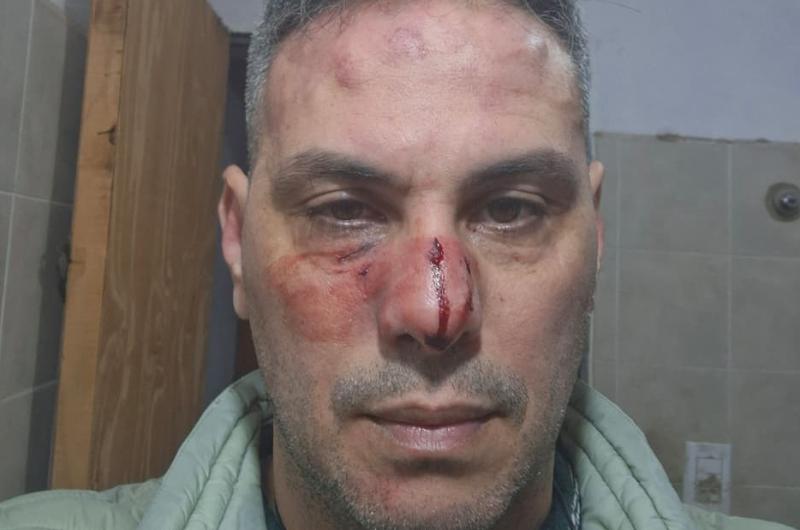 Vecino de Tintina reprocha a sujetos por orinar al aire libre frente a su sobrina menor y recibe una golpiza