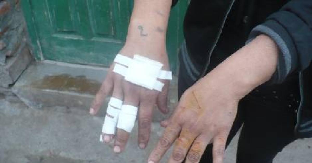 Joven queriacutea pantildeales para cambiar por droga y golpeoacute a su madre