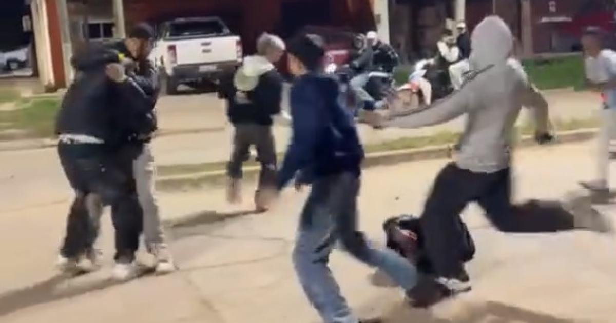 Escalofriante agresioacuten- patada criminal provocoacute heridas a joven