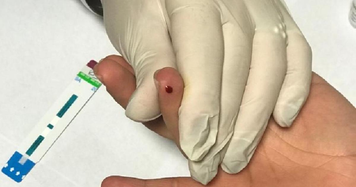 Prueba de VIH- recuerda la necesidad de conocer a tiempo el diagnoacutestico