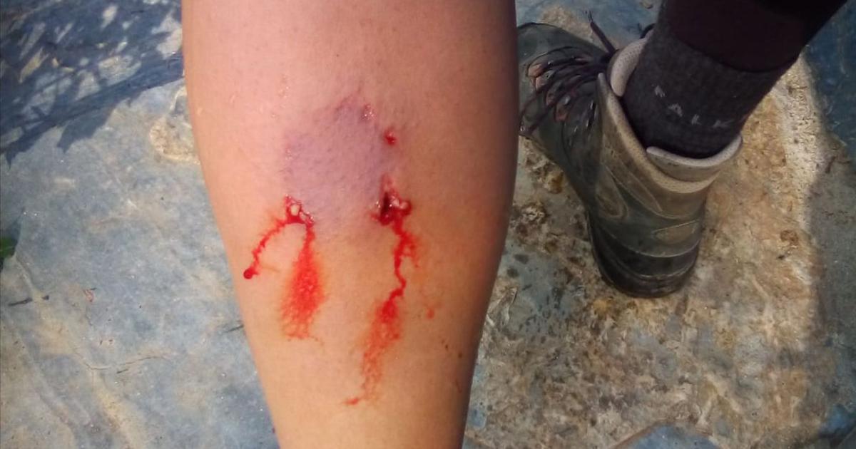 Una mujer sufrioacute graves lesiones tras ser atacada por un perro en la calle