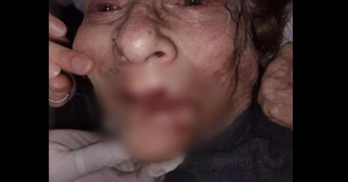VIDEO  Indignante- quieacuten es el enfermero filmado mientras golpeaba a una anciana en un geriaacutetrico