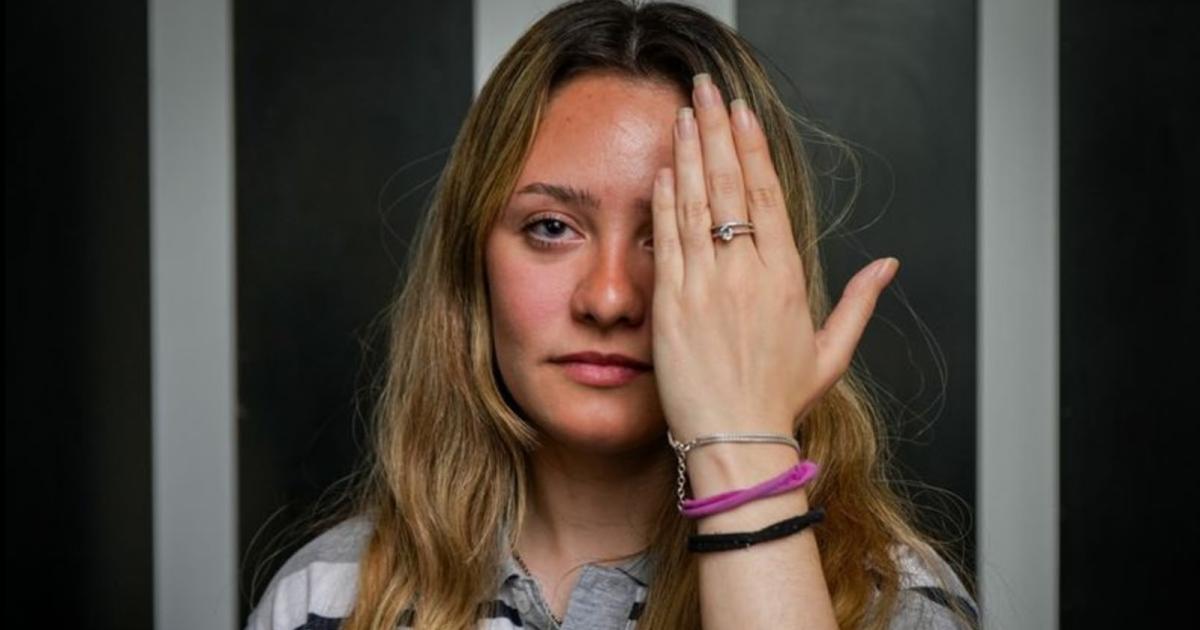 La conmovedora historia detraacutes de la ley de bullying- perder un ojo a los 13 y transformar el dolor en prevencioacuten