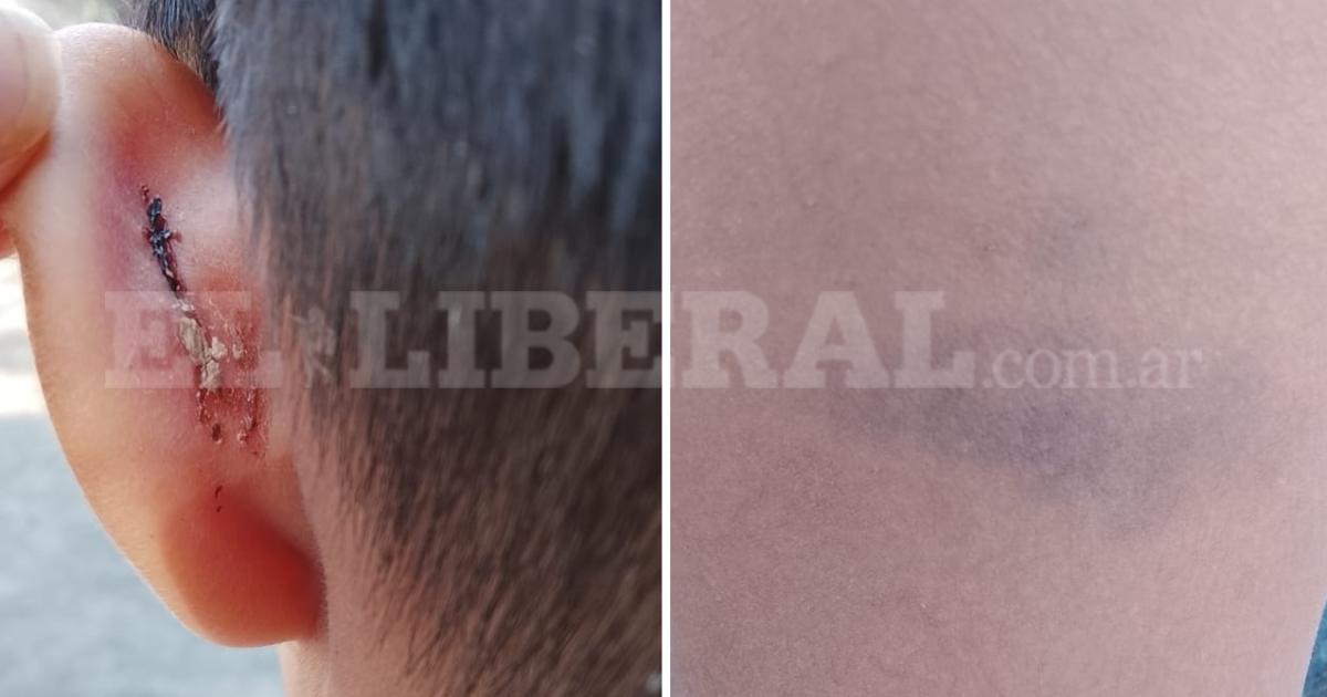Sus hijos golpeados y cortados en oreja y pierna