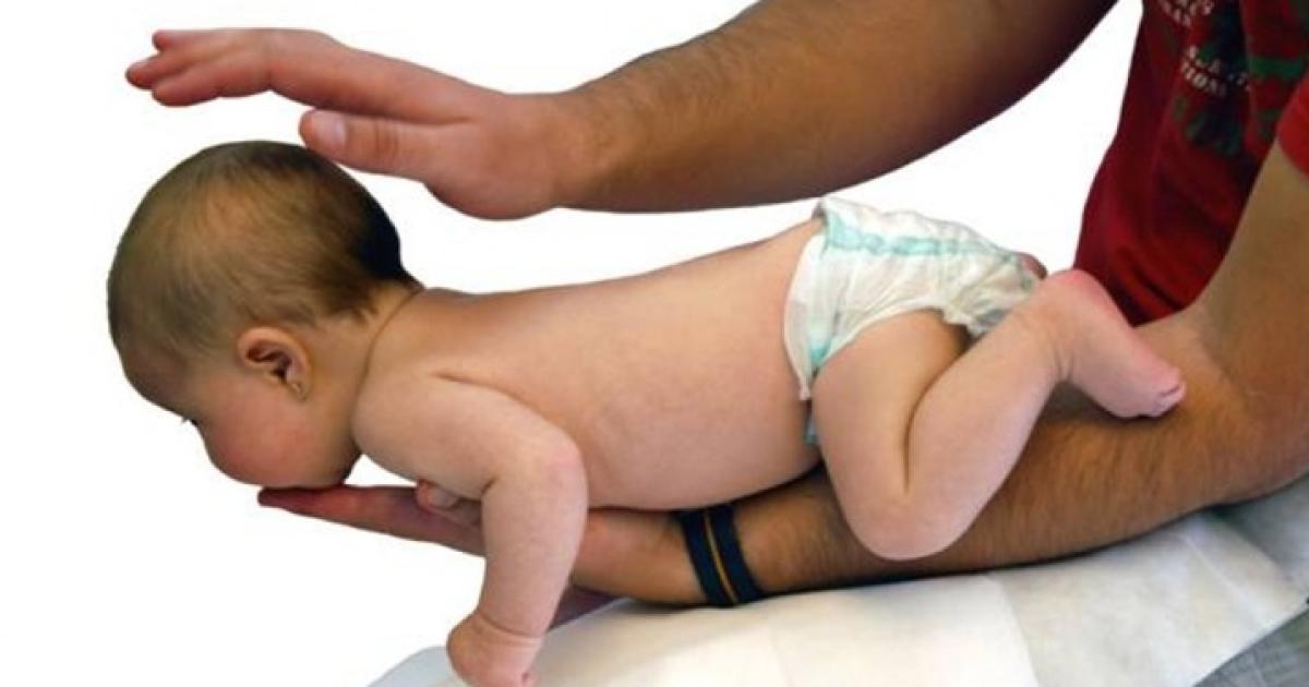 Tragedia evitable- las 10 reglas de oro para prevenir la asfixia en bebeacutes y nintildeos en el hogar