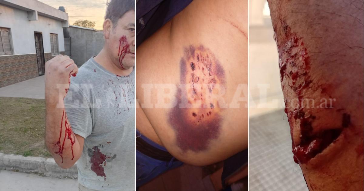 AL ROJO VIVO La sangre y la carne reflejan la fiereza de las garras y sus consecuencias