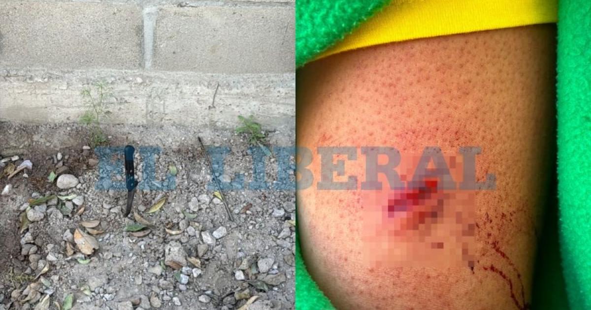 Una mujer resultoacute herida tras ser atacada con un elemento punzante