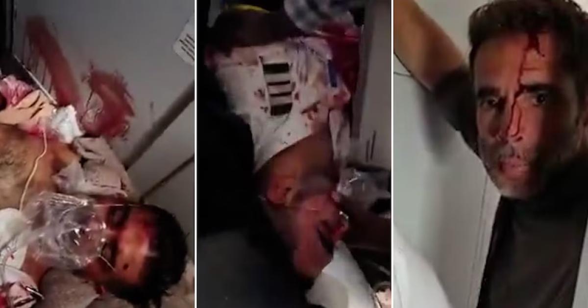 Tres fotogramas de un video registran a un hombre herido con manchas de sangre en el rostro mientras recibe atención médica y permanece de pie