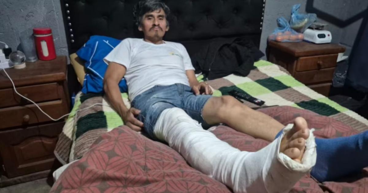 El hombre recibió un disparo en una pierna durante el robo y permanece en reposo