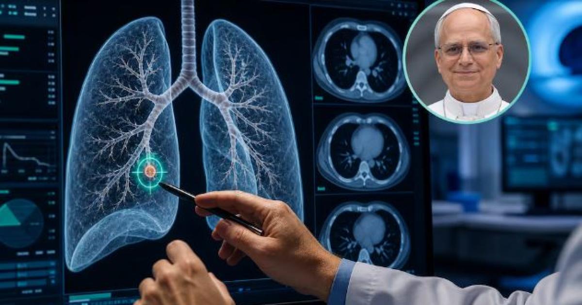 Operacioacuten al papa Leoacuten XIV por un noacutedulo pulmonar- de queacute se trata el procedimiento y queacute revelan los especialistas