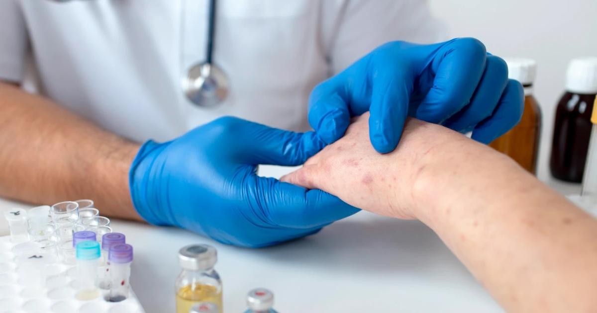 Siacutefilis- los diagnoacutesticos en mujeres aumentaron un 26-en-porciento-
