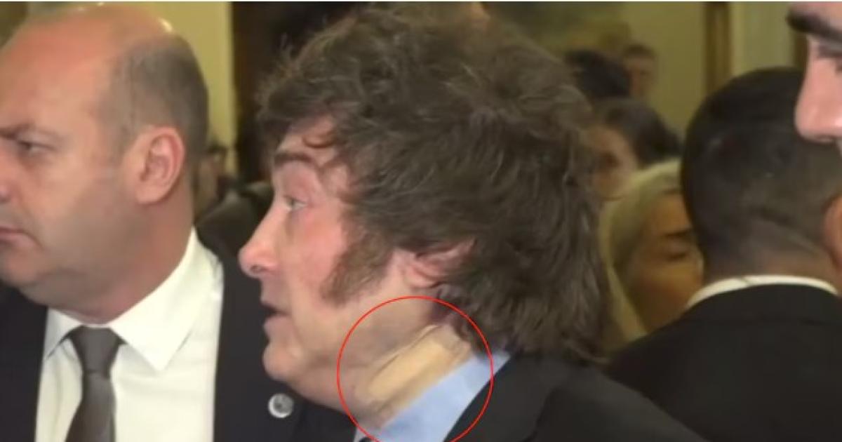 Javier Milei se presentó en un foro de Madrid con un vendaje en el cuello debido a un golpe a la salida de la bañadera