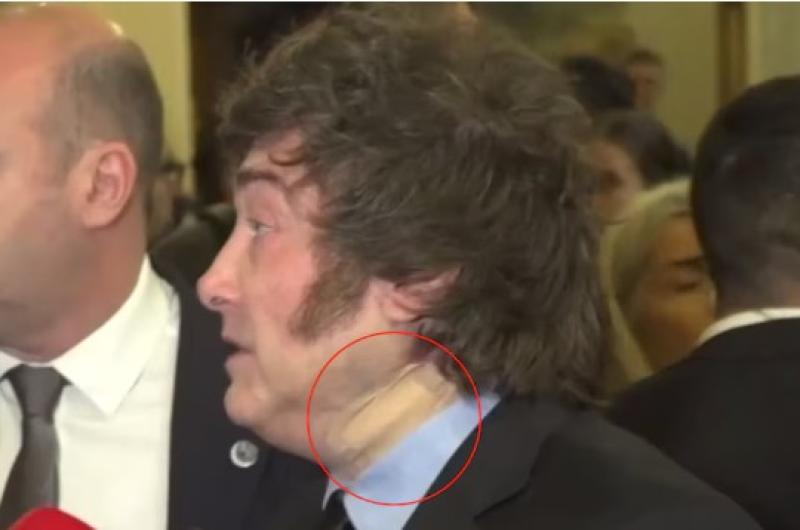 Javier Milei se presentó en un foro de Madrid con un vendaje en el cuello debido a un golpe a la salida de la bañadera