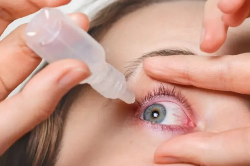 Ojo seco: causas más frecuentes, síntomas clave y cómo prevenir complicaciones